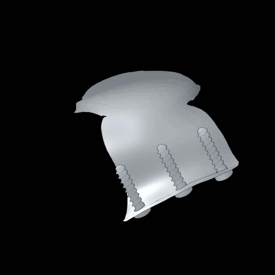 Reconstruction du toit de l’orbite